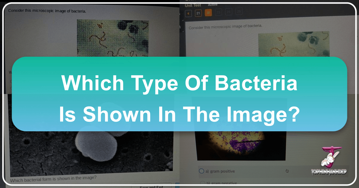 /images/which-type-of-bacteria-is-shown-in-the-image.png